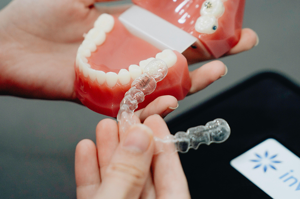 Invisalign
