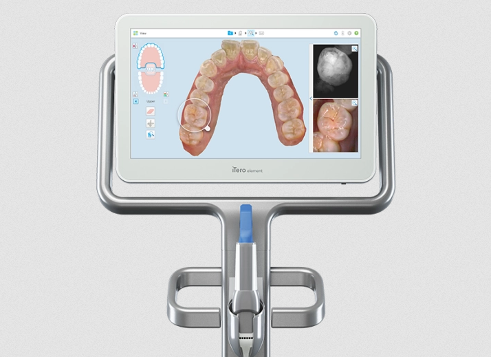 iTero Digital Scanner